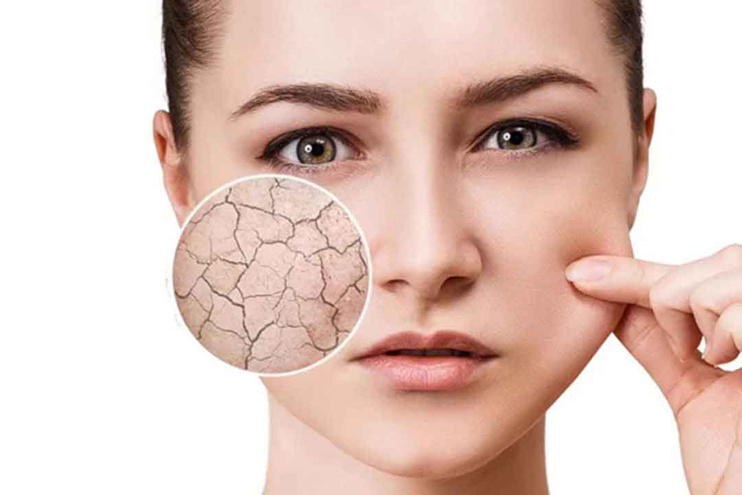 عوامل و دلایل اصلی خشکی پوست