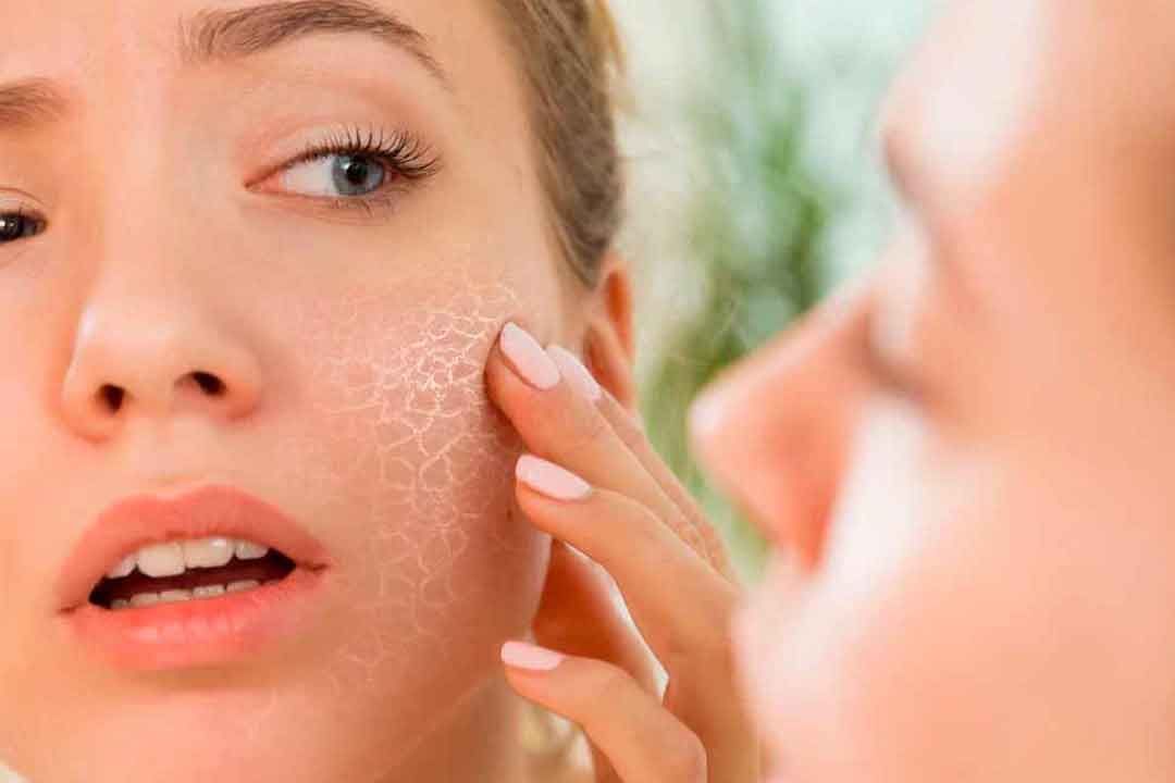 عوامل و دلایل اصلی خشکی پوست